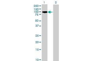 Lane 1: CENPC1 transfected lysate ( 61. (CENPC1 293T Cell Transient Overexpression Lysate(Denatured))
