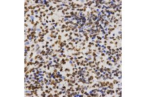Immunohistochemistry of paraffin-embedded human kidney tissue using H3K27me2 antibody at dilution of 1:200 (x400 lens). (Histone 3 antibody  (H3K27me))