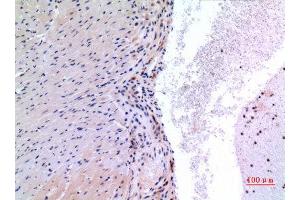 Immunohistochemistry (IHC) analysis of paraffin-embedded Mouse Heart, antibody was diluted at 1:100. (VEGFC antibody  (Internal Region))