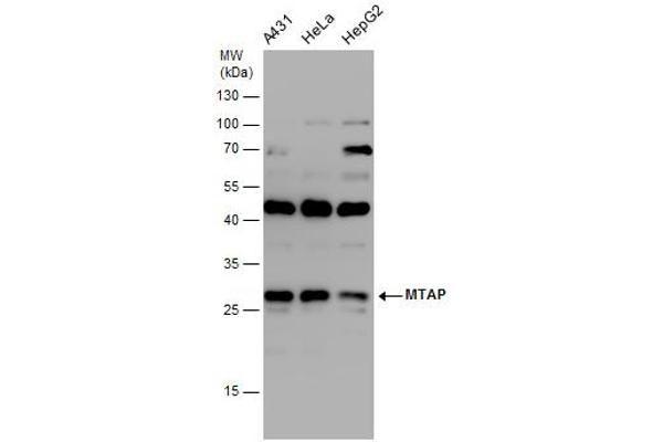 MTAP antibody