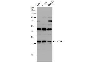 WB Image MTAP antibody detects MTAP protein by western blot analysis.