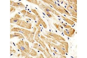 IHC analysis of FFPE human heart section using SMAD1 antibody; Ab was diluted at 1:25. (SMAD1 antibody  (AA 163-196))