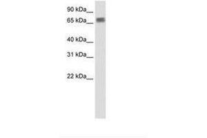 Image no. 1 for anti-Zinc Finger Protein 64 (ZFP64) (N-Term) antibody (ABIN203231) (ZFP64 antibody  (N-Term))