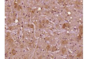 Paraformaldehyde-fixed, paraffin embedded Rat Brain; Antigen retrieval by boiling in sodium citrate buffer (pH6) for 15min; Block endogenous peroxidase by 3% hydrogen peroxide for 30 minutes; Blocking buffer (normal goat serum) at 37°C for 20min; Antibody incubation with CASK/CAMGUK Polyclonal Antibody, Unconjugated (bs-11338R) at 1:200 overnight at 4°C, followed by a conjugated secondary and DAB staining. (CASK antibody  (AA 651-750))