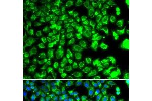 Immunofluorescence analysis of MCF-7 cells using C10orf32 Polyclonal Antibody (C10ORF32 antibody)