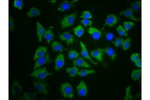 Immunofluorescence staining of A549 cells with ABIN7148438 at 1:66, counter-stained with DAPI.