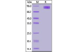 Human IL-17 RC, Fc Tag on  under reducing (R) condition. (IL17RC Protein (AA 21-465) (Fc Tag))