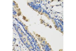 Immunohistochemistry of paraffin-embedded mouse lung using IL36G antibody (ABIN5974550) at dilution of 1/100 (40x lens). (IL1F9 antibody)