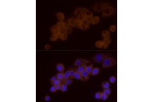 Immunofluorescence analysis of HepG2 cells using DTYMK Rabbit mAb (ABIN7266735) at dilution of 1:25 (40x lens).
