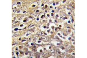 IHC analysis of FFPE human placenta tissue stained with Aromatase antibody (Aromatase antibody  (AA 453-485))