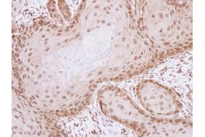 IHC-P Image Immunohistochemical analysis of paraffin-embedded Cal27 xenograft , using ML-IAP, antibody at 1:100 dilution. (BIRC7 antibody)