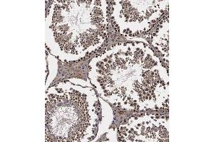Immunohistochemistry (Paraffin-embedded Sections) (IHC (p)) image for anti-LATS, Large Tumor Suppressor, Homolog 2 (Drosophila) (LATS2) (AA 1000-1027), (C-Term) antibody (ABIN1881491)