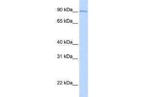 Human Lung; WB Suggested Anti-AOC2 Antibody Titration: 0. (AOC2 antibody  (Middle Region))