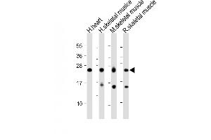 All lanes : Anti-MYL1 Antibody (Center) at 1:2000 dilution Lane 1: Human heart lysate Lane 2: Human skeletal muslce lysate Lane 3: Mouse skeletal muscle lysate Lane 4: Rat skeletal muscle lysate Lysates/proteins at 20 μg per lane. (MYL1 antibody  (AA 101-135))