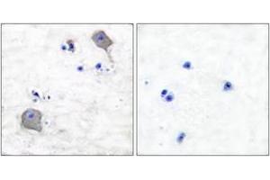 Immunohistochemistry analysis of paraffin-embedded human brain tissue, using Claudin 5 Antibody. (Claudin 5 antibody  (AA 169-218))