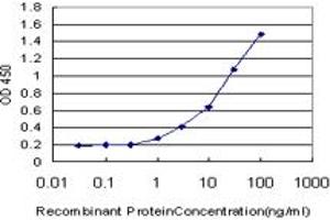 Detection limit for recombinant GST tagged MAP3K5 is approximately 1ng/ml as a capture antibody. (ASK1 antibody  (AA 1231-1374))