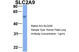 Host:  Rabbit  Target Name:  SLC2A9  Sample Type:  Human Fetal Lung  Antibody Dilution:  1. (SLC2A9 antibody  (Middle Region))