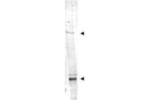 Western blot using  Affinity Purified anti-IDN3 antibody shows detection of bands at ~315 kDa and ~125 kDa corresponding to isoforms of IDN3 (arrow-heads) in mouse heart whole cell tissue extract. (NIPBL antibody  (AA 344-356))