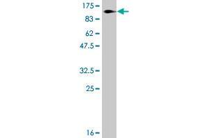 Western Blot detection against Immunogen (120. (DDR1 antibody  (AA 22-876))