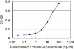 Detection limit for recombinant GST tagged RXRB is 0. (Retinoid X Receptor beta antibody  (AA 161-260))