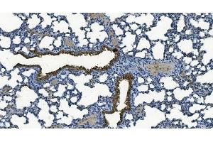 IHC analysis of MCU using anti-MCU antibody (ABIN7601931). (MCU antibody  (AA 51-351))