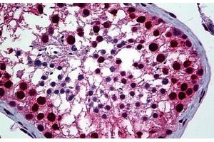 Human Testis: Formalin-Fixed, Paraffin-Embedded (FFPE) (YY1 antibody  (AA 221-321))