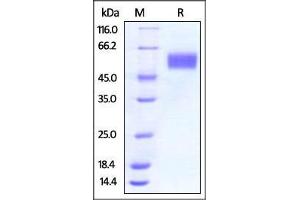 Vaccinia Virus B18R, His Tag on SDS-PAGE under reducing (R) condition. (Vaccinia Virus B18R (VACV B18R) (AA 20-351) (Active) protein (His tag))