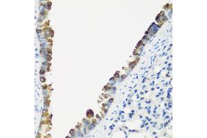 Immunohistochemistry of paraffin-embedded mouse lung using TNNC2 antibody (ABIN6129604, ABIN6149353, ABIN6149354 and ABIN6223680) at dilution of 1:200 (40x lens).