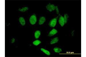 Immunofluorescence of purified MaxPab antibody to KIAA0261 on HeLa cell. (WAPAL antibody  (AA 1-402))