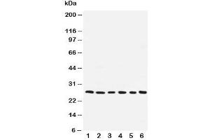 Western blot testing of ARC antibody and human samples 1:  SMMC-7721;  2: A549;  3: U87;  4: HeLa;  5: MCF-7;  6: rat liver (NOL3 antibody  (AA 91-106))