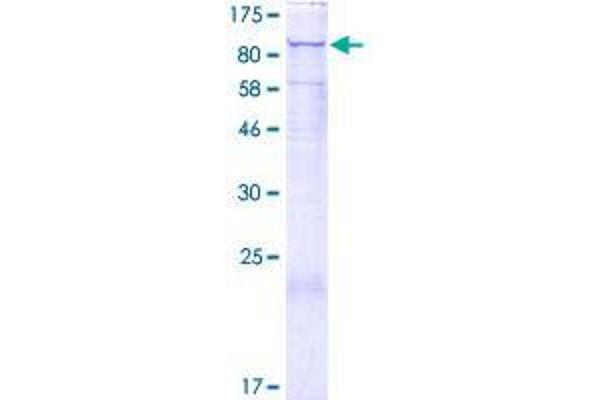 DSE Protein (AA 1-958) (GST tag)