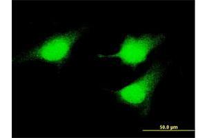 Immunofluorescence of monoclonal antibody to MAP2K5 on HeLa cell. (MAP2K5 antibody  (AA 1-120))