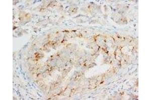 Image no. 1 for anti-Opioid Binding Protein/cell Adhesion Molecule-Like (OPCML) (C-Term) antibody (ABIN1492945) (OPCML antibody  (C-Term))