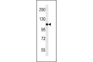 USO1 Antibody (C-term) (ABIN657956 and ABIN2846901) western blot analysis in ZR-75-1 cell line lysates (35 μg/lane). (USO1 antibody  (C-Term))