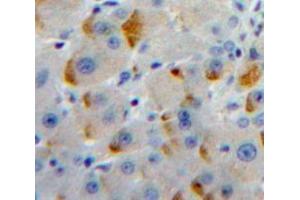 Immunohistochemistry (IHC) image for anti-Integrin beta 1 (ITGB1) (AA 467-635) antibody (ABIN1859500)