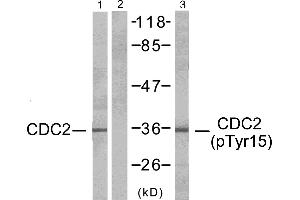 Western blot analysis of extracts from HepG2 cells, CDC2 (Ab-15) antibody (#Line 1 and 2) and CDC2 (phospho-Tyr15) antibody (Line 3). (CDK1 antibody  (pTyr15))