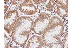 IHC-P Image Immunohistochemical analysis of paraffin-embedded human gastric tissue, using DIAPH1, antibody at 1:100 dilution.