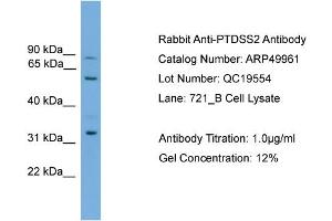WB Suggested Anti-PTDSS2  Antibody Titration: 0. (PTDSS2 antibody  (Middle Region))
