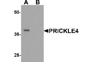 Western Blotting (WB) image for anti-Prickle Homolog 4 (PRICKLE4) (N-Term) antibody (ABIN1077371) (PRICKLE4 antibody  (N-Term))