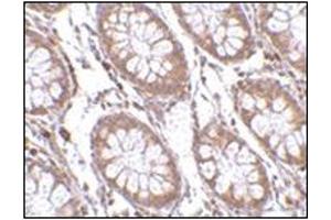 Immunohistochemistry of PTK7 in human colon tissue with this product at 2. (PTK7 antibody  (C-Term))
