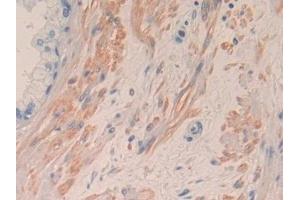 Detection of IL8 in Human Prostate Tissue using Monoclonal Antibody to Interleukin 8 (IL8) (IL-8 antibody  (AA 28-99))
