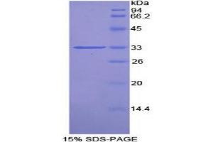 SDS-PAGE (SDS) image for Proto-Oncogene Pim-2 (Serine Threonine Kinase) (PIM2) (AA 34-292) protein (His tag) (ABIN2126305)