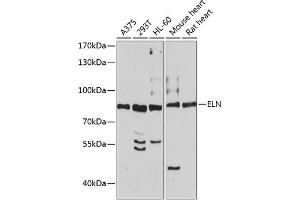 Western blot analysis of extracts of various cell lines, using ELN antibody (ABIN3016530, ABIN3016531, ABIN3016532 and ABIN6219774) at 1:1195 dilution. (Elastin antibody  (AA 27-200))