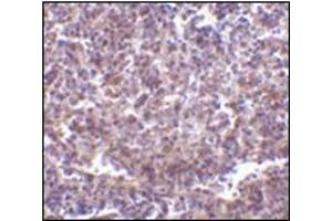 Immunohistochemistry of RP105 in human spleen tissue with this product at 2 μg/ml. (CD180 antibody  (N-Term))