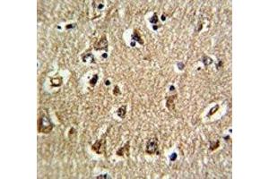 IHC analysis of FFPE human brain tissue stained with RAN antibody (RAN antibody  (AA 12-39))