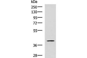 Western blot analysis of TM4 cell lysate using RAB3IL1 Polyclonal Antibody at dilution of 1:600 (RAB3IL1 antibody)