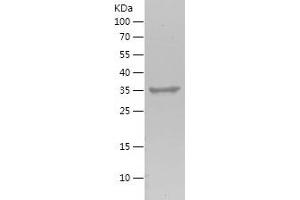 Western Blotting (WB) image for StAR-Related Lipid Transfer (START) Domain Containing 5 (STARD5) (AA 47-146) protein (His-IF2DI Tag) (ABIN7282781) (STARD5 Protein (AA 47-146) (His-IF2DI Tag))