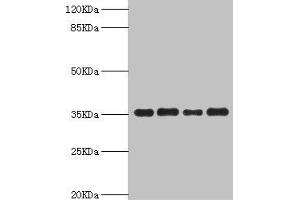 Western blot All lanes: PDXK antibody at 5. (PDXK antibody  (AA 1-312))