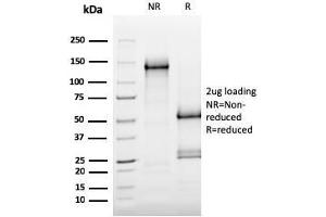SDS-PAGE Analysis Purified MerTK Mouse Monoclonal Antibody (MERTK/3015). (MERTK antibody  (AA 55-148))