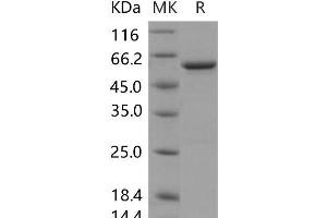 Western Blotting (WB) image for Glutamate Decarboxylase 2 (Pancreatic Islets and Brain, 65kDa) (GAD2) protein (ABIN7320200) (GAD65 Protein)